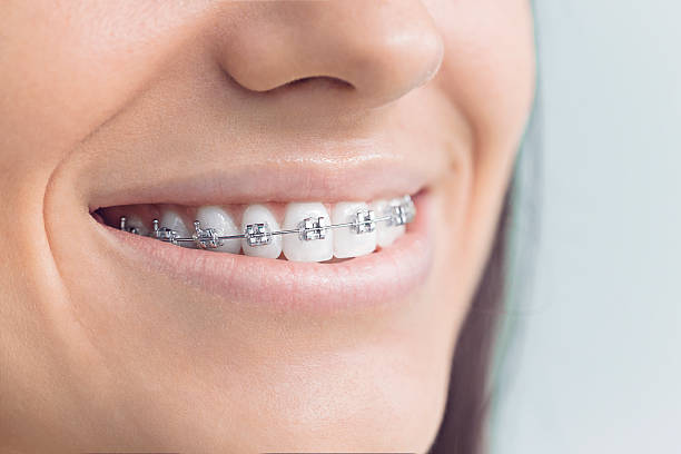 Professional  Holistic Dental Services in Zephyrhills West, FL